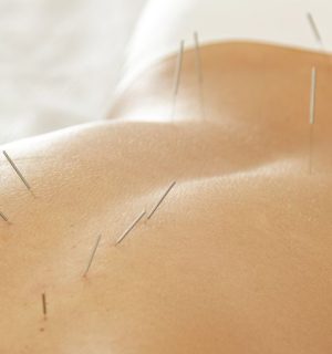 Lyst og roligt behandlingsrum hos Clinic Lifestyle, ideelt til akupunkturbehandlinger.